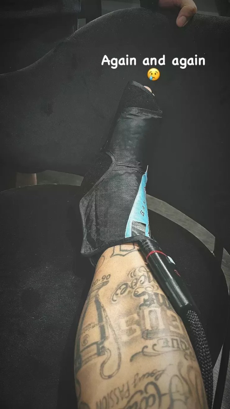 Неймар выложил фотографию ноги после травмы